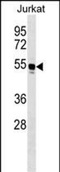 WARS Antibody (C-term)