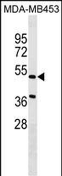NPNT Antibody (Center)