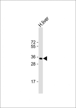 GNMT Antibody (Center)