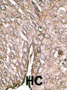 LC3 Antibody (APG8A/B)