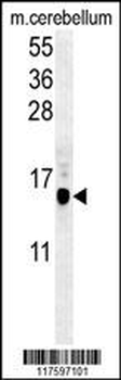 APG8b (MAP1LC3B)-T93/Y99 Antibody (Center)