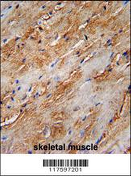 APG8b (MAP1LC3B)-T93/Y99 Antibody (Center)
