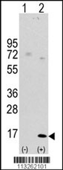 LC3 Antibody (APG8A) (D106)