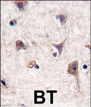 LC3 Antibody (APG8A) (N-term)