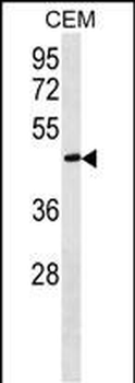 FBLN5 Antibody (C-term)