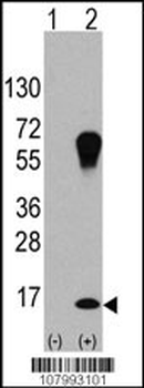 LC3 Antibody (APG8A)