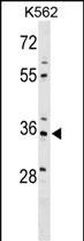 PDLIM4 Antibody (Center)