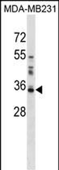 LGALS8 Antibody (C-term)