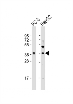 LGALS8 Antibody (C-term)