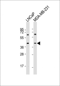 LGALS8 Antibody (C-term)