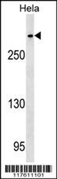 CENPE Antibody (C-term)