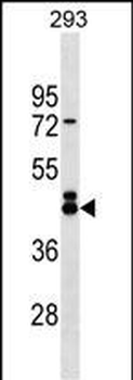 EFCAB4B Antibody (N-term)
