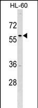 TFAP2D Antibody (C-term)