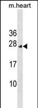 INCA1 Antibody (N-term)