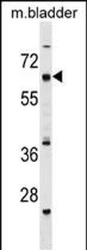 CECR6 Antibody (C-term)