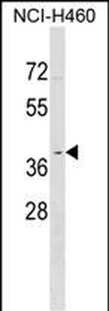 OR2Y1 Antibody (C-term)