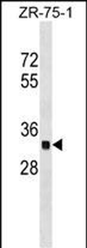 OR2C3 Antibody (C-term)