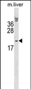 Mouse Hoxb6 Antibody (N-term)