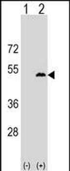 LPXN Antibody (Center)