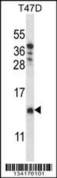 CHCH8 Antibody (C-term)
