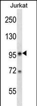 SR140 Antibody (N-term)