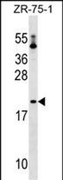 PTRH1 Antibody (Center)
