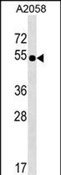 NHEDC2 Antibody (C-term)