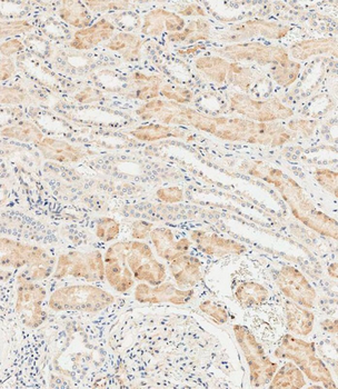 LZIC Antibody (Center)
