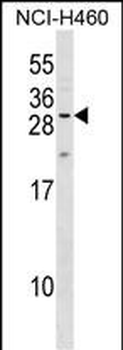 MPZL2 Antibody (Center)