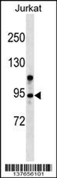 ZMYM6 Antibody (N-term)
