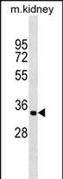 ZFP36L2 Antibody (Center)