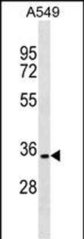 PACRG Antibody (N-term)