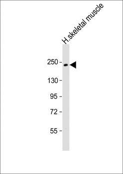 MYH7 Antibody (N-term)