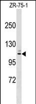 MARCH10 Antibody (Center)