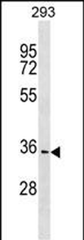 PBLD Antibody (C-term)