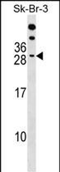 RAP2B Antibody (Center)