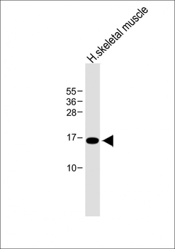 EMP1 Antibody (N-term)