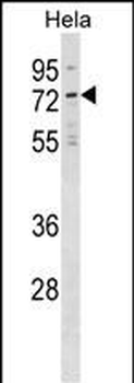 NET1 Antibody (Center)