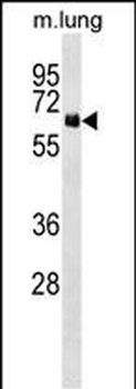 NET1 Antibody (Center)