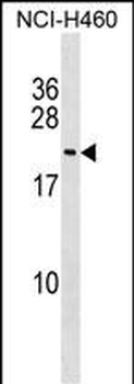 FUNDC1 Antibody (N-term)