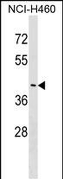 FEZ2 Antibody (N-term)