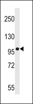 AGAP3 Antibody (N-term)