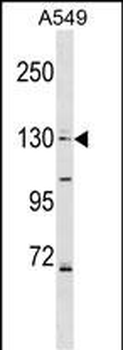 COL4A6 Antibody (Center)