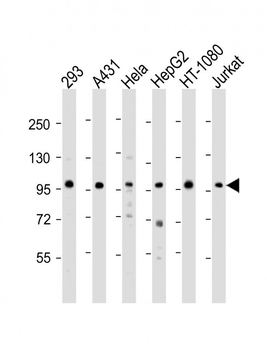 DDX21 Antibody (N-term)