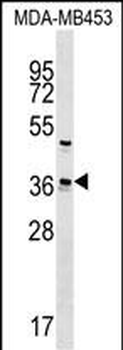 UBE2Z Antibody (C-term)