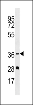 OR5M1 Antibody (C-term)