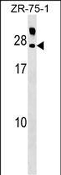 IL19 Antibody (N-term)