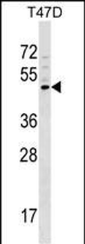 GCNT1 Antibody (Center)