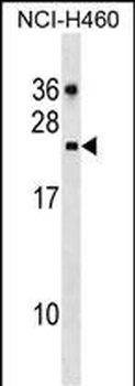 CDC42EP2 Antibody (C-term)