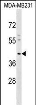 KCNJ15 Antibody (C-term)